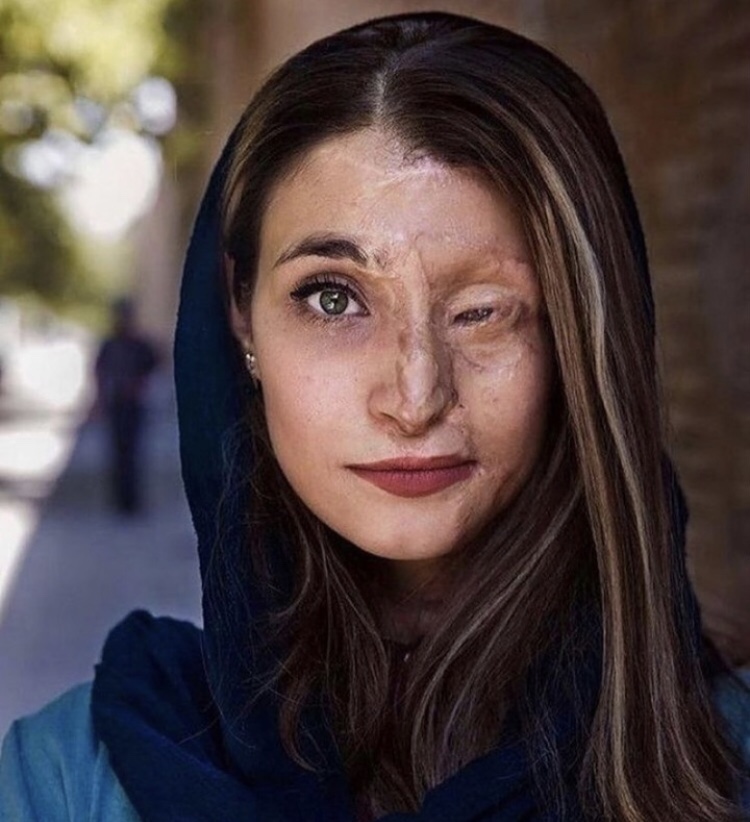 Marzieh Ebrahimi, Iranian figurehead